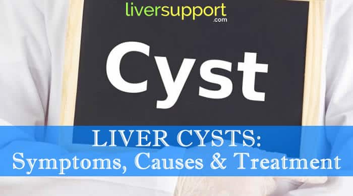 Liver Cysts: Symptoms, Causes and Treatment