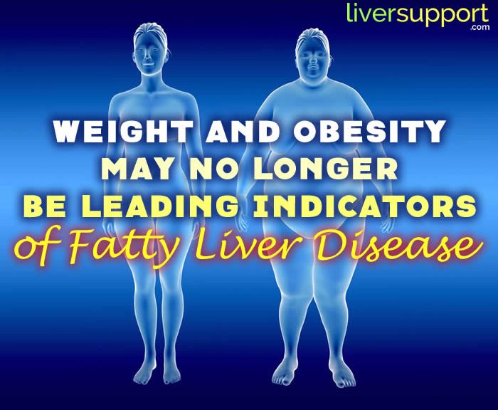 Weight and Obesity May No Longer Be Leading Indicators of Fatty Liver Disease