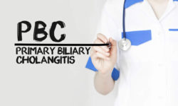 New Therapy for Primary Biliary Cholangitis Patients