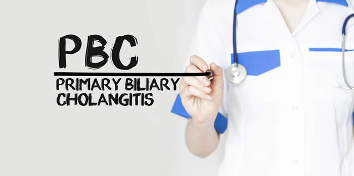 New Therapy for Primary Biliary Cholangitis Patients